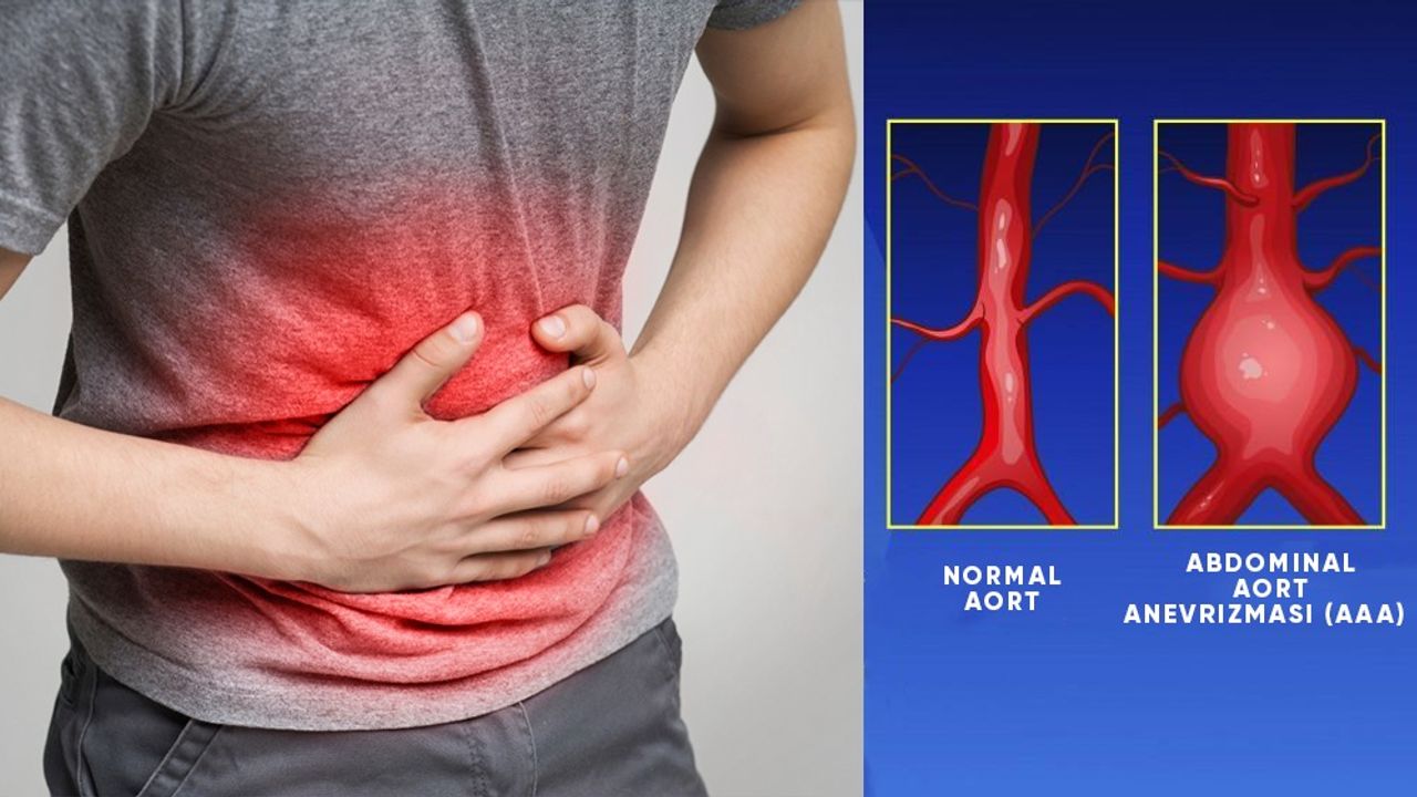 Abdominal Aort Anevrizması (AAA) ve EVAR Tedavisinde Son Gelişmeler