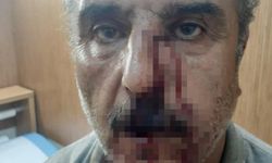 Aile hekimi, emekli öğretmeni darpla hastanelik etti