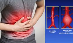 Abdominal Aort Anevrizması (AAA) ve EVAR Tedavisinde Son Gelişmeler