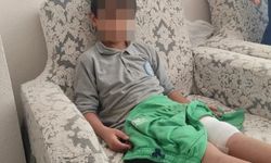 Sokak köpekleri okula giden çocuğu hastanelik etti