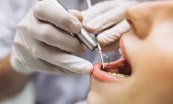 Emekliye ve Vatandaşa Müjde! MHP’den Kritik Teklif: İmplant Tedavisi SGK Kapsamına Alınsın!