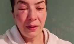 Kütahya’da Şoke Eden İddia: Sokak Hayvanlarına Bakan Kadın Darp Edildi