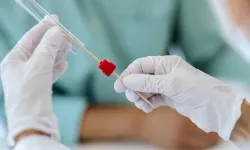 Kütahya’da Kanserle Mücadelede Büyük Seferberlik: Taramalar Tamamen Ücretsiz!