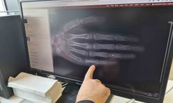 Aileler Dikkat! Her ay 5 ila 7 çocuğa kanser tanısı konuluyor