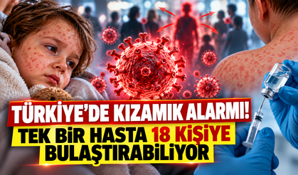 Türkiye’de Kızamık Alarmı! Tek Bir Hasta 18 Kişiye Bulaştırabiliyor