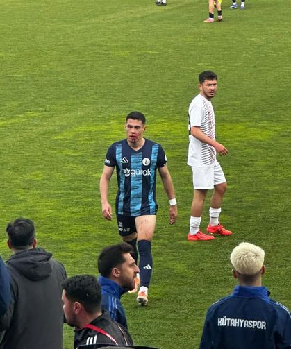 Kütahyaspor maçında korkutan an: Okan Erdik kanlar içinde kaldı