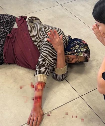 Komşuda Dehşet! Köpek Kadının Kolunu Kopardı