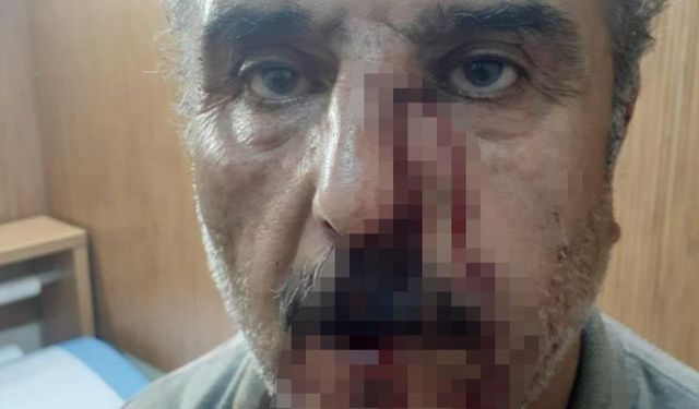 Aile hekimi, emekli öğretmeni darpla hastanelik etti