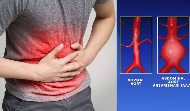 Abdominal Aort Anevrizması (AAA) ve EVAR Tedavisinde Son Gelişmeler