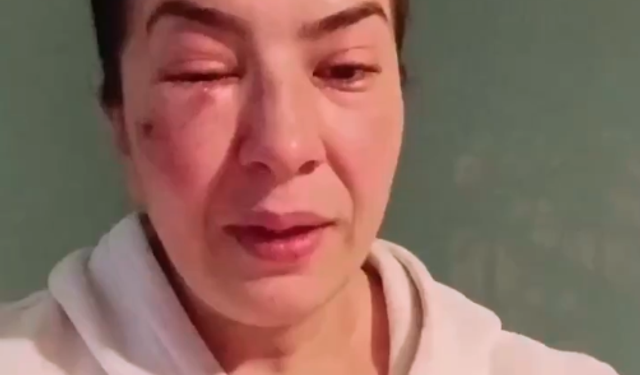 Kütahya’da Şoke Eden İddia: Sokak Hayvanlarına Bakan Kadın Darp Edildi