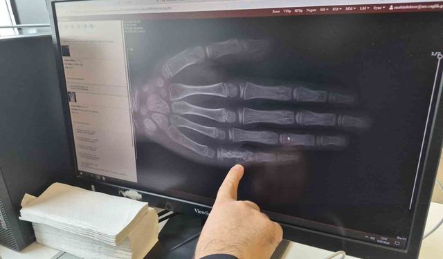 Aileler Dikkat! Her ay 5 ila 7 çocuğa kanser tanısı konuluyor