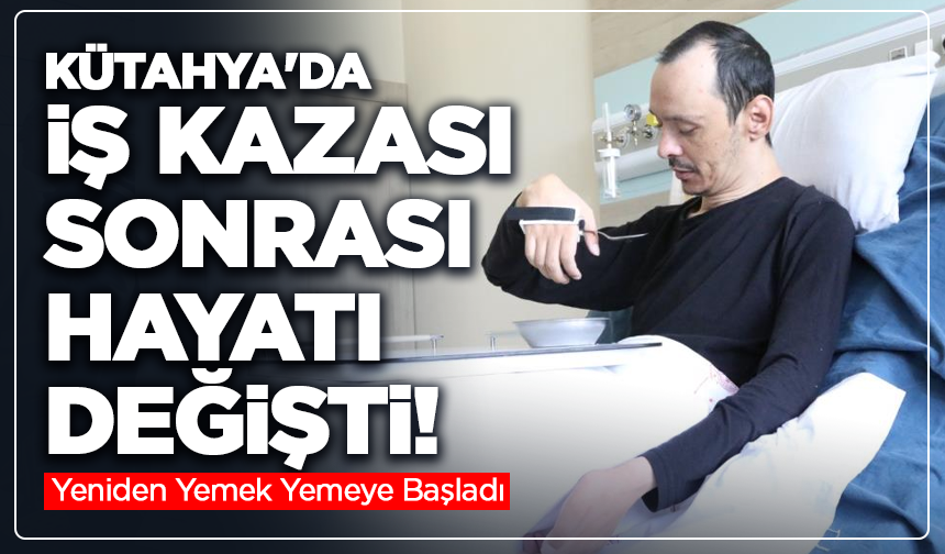 Kütahya'da iş kazası sonrası hayatı değişti! Yeniden Yemek Yemeye Başladı