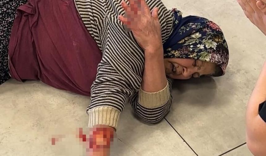 Komşuda Dehşet! Köpek Kadının Kolunu Kopardı