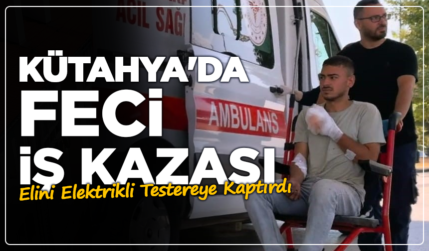 Kütahya'da Feci İş Kazası: Elini Elektrikli Testereye Kaptırdı