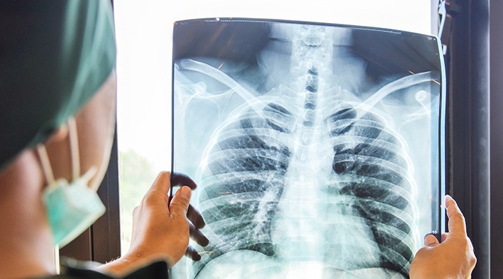 1F8F7405 C78E 45D2 Ac7E 8Aa331A1777D