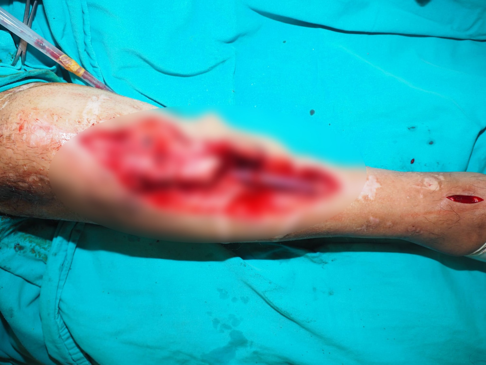 4E763A7A 4207 4Cbe Ae91 2C3541C7A12A