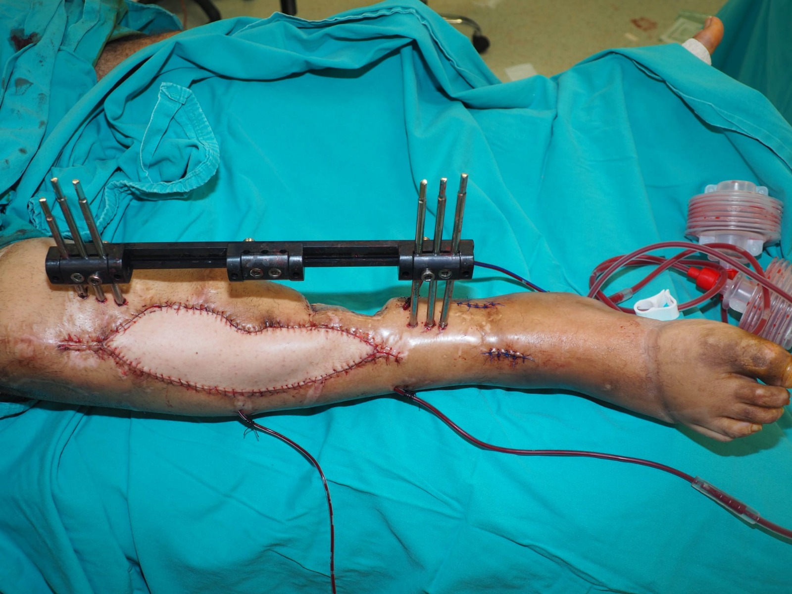 974B64F9 9A19 4E53 8C8E F904860124D5