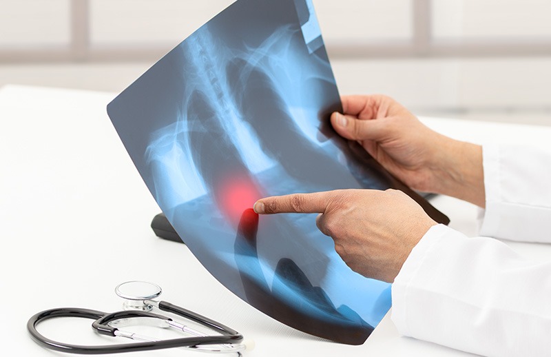 Abc0Bf85 994C 4Da4 B8E0 0D73C69E05C0